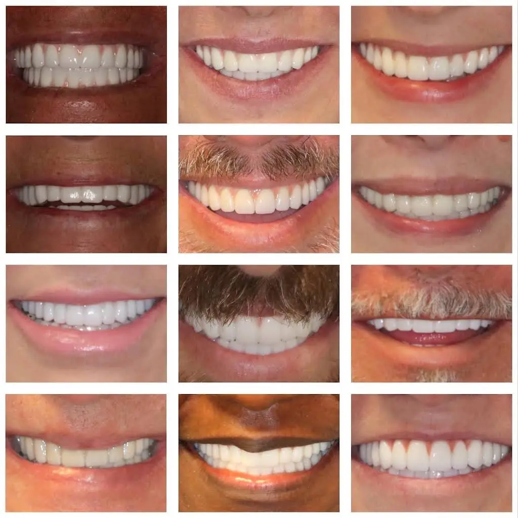 Smart Arches Dental Implants - Bartonsville