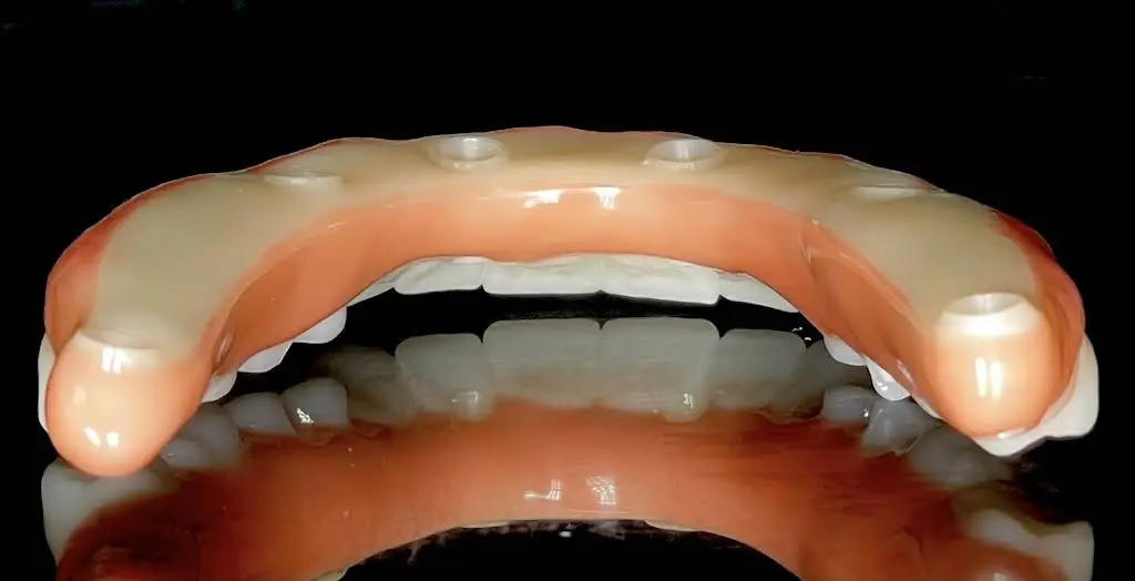 Affordable Dentures & Implants