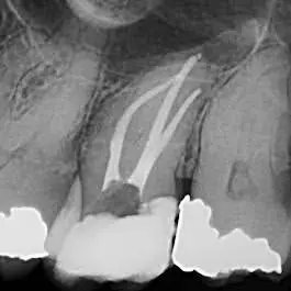 North Penn Endodontics Group