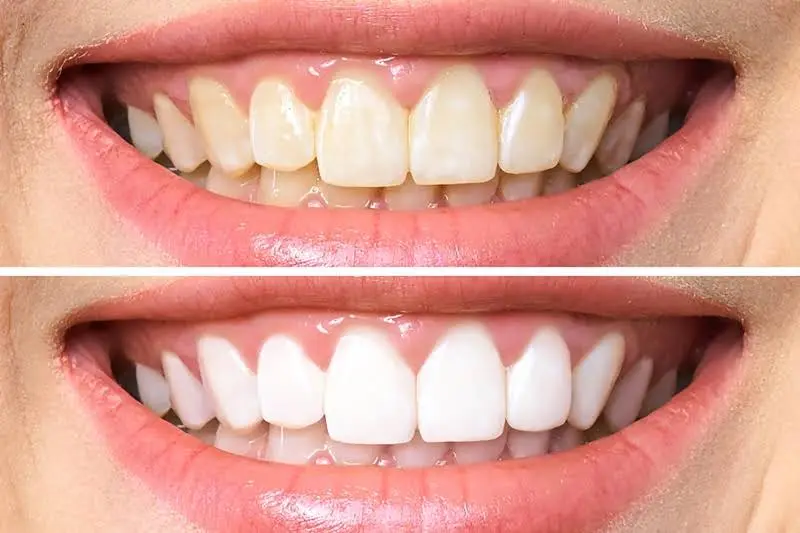 Hazzouri Dental