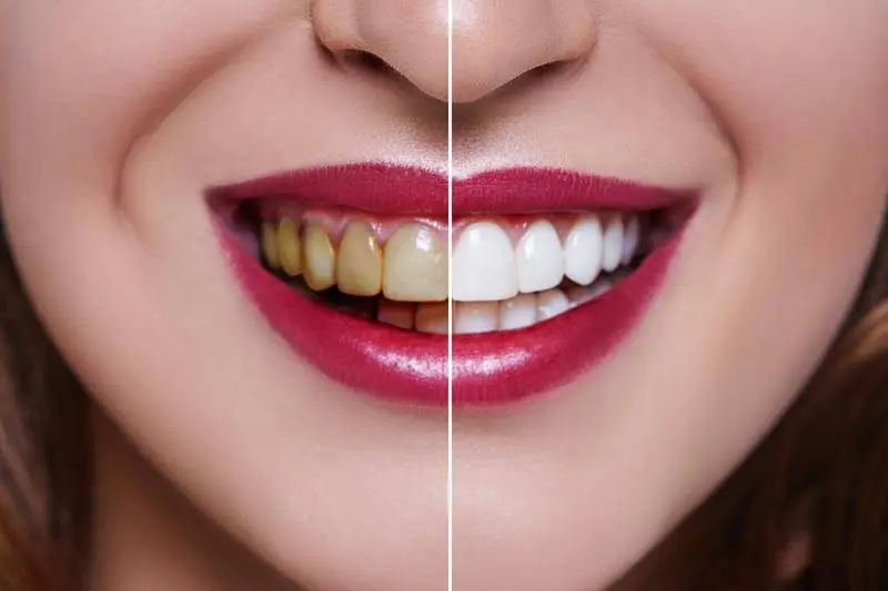 Hazzouri Dental