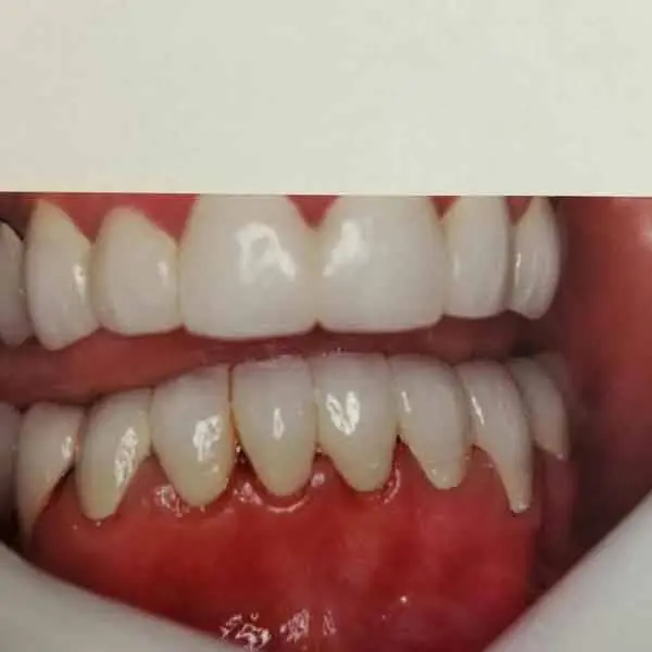 Chemung Family Dental