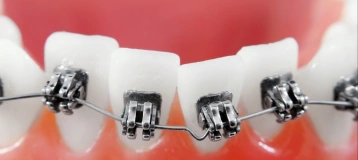 Orthodontics Unlimited
