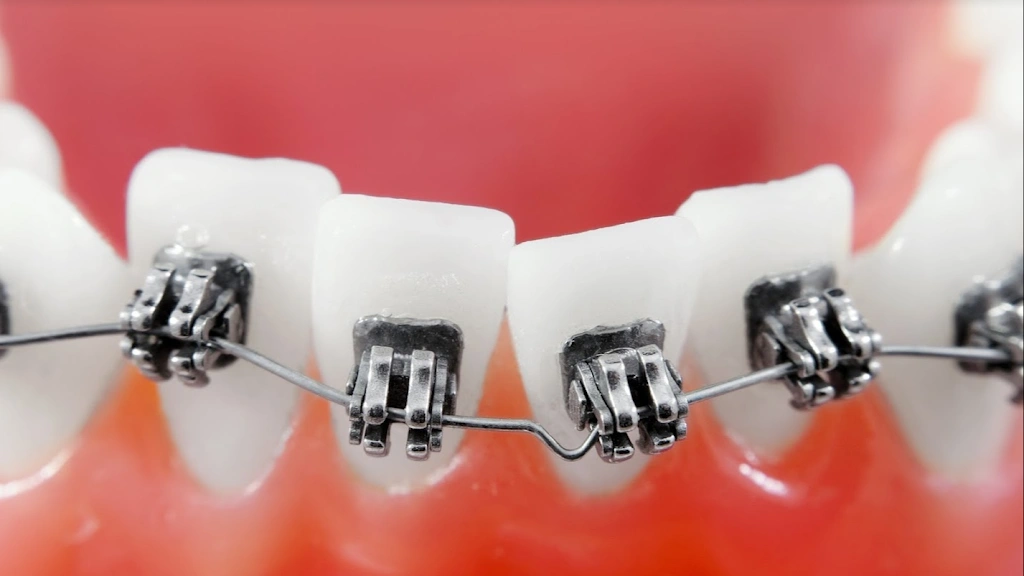 Orthodontics Unlimited - Professional dental clinic exterior with modern facilities