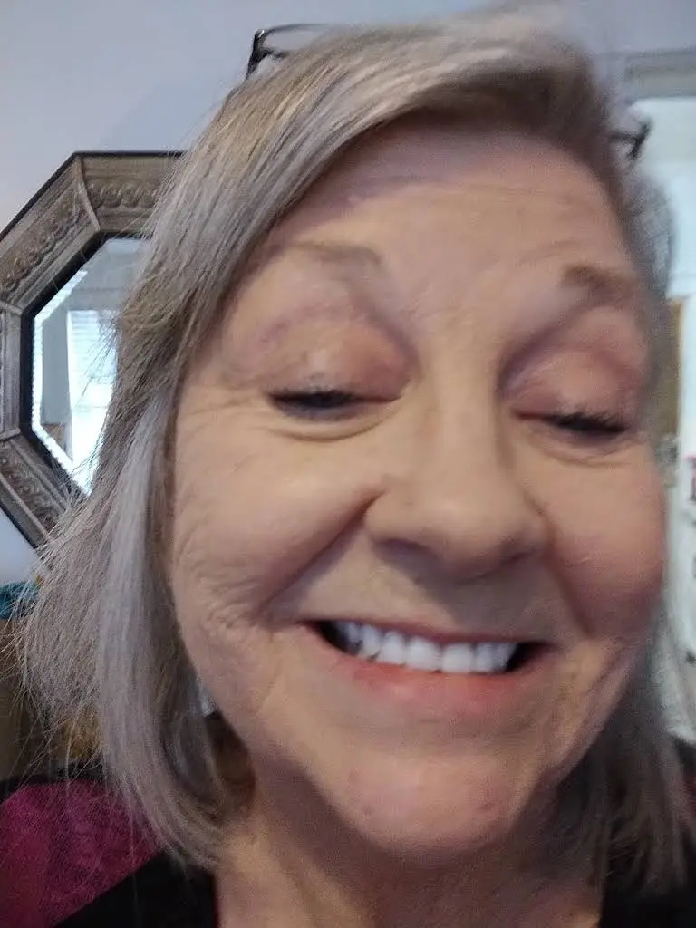 Edwards Dentures and Implants