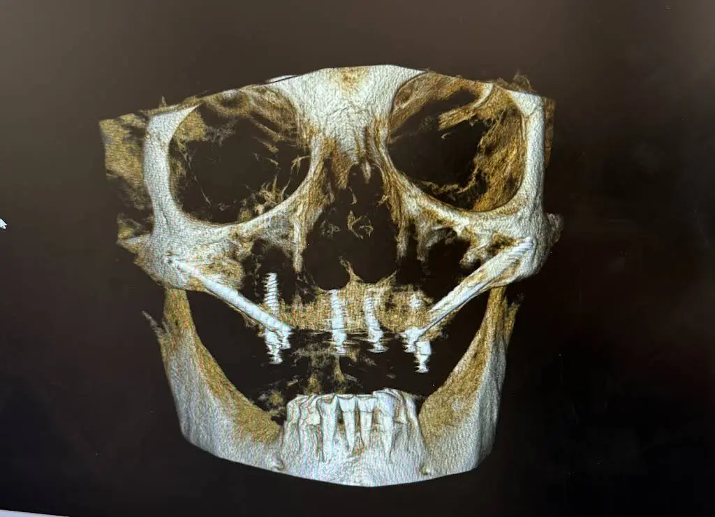 Otero Cosmetic and Implant Dentistry