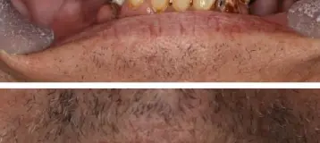 Care First Dental Team