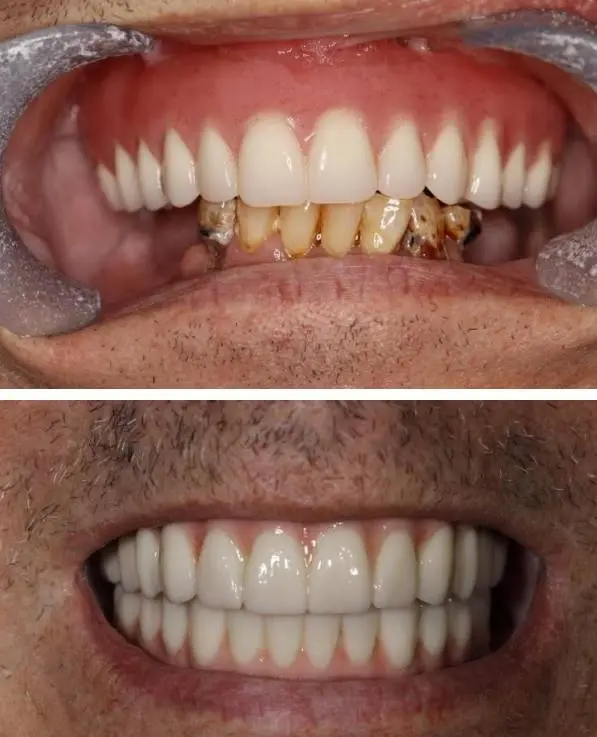 Care First Dental Team - Professional dental clinic exterior with modern facilities