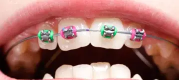 Viechnicki Orthodontics