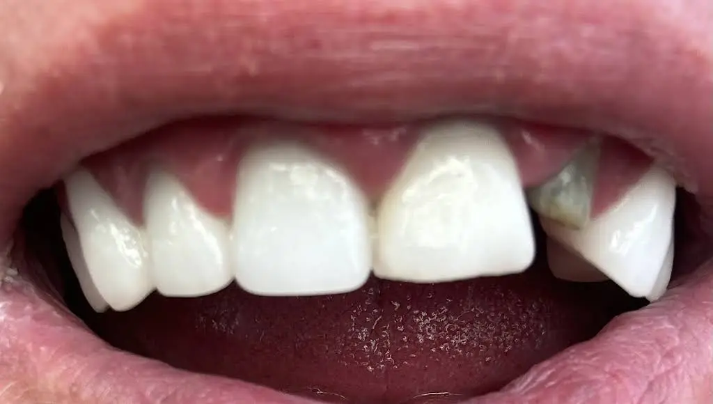 Horizon Dental Care Of Honesdale