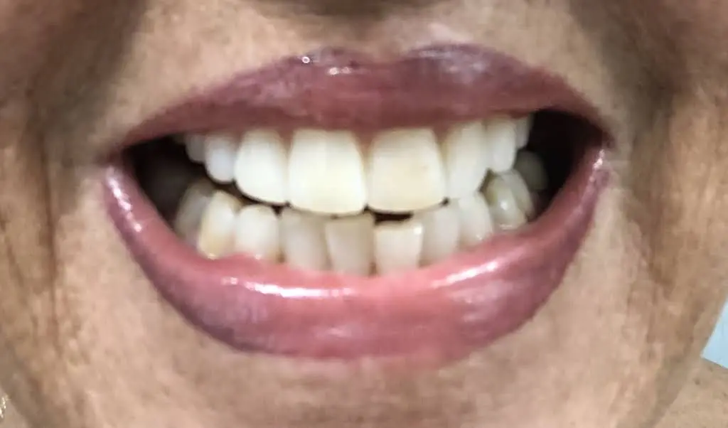 Family Dental Health of Spring Valley North