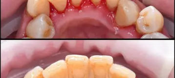 Eco Dental - He Harry Y DDS