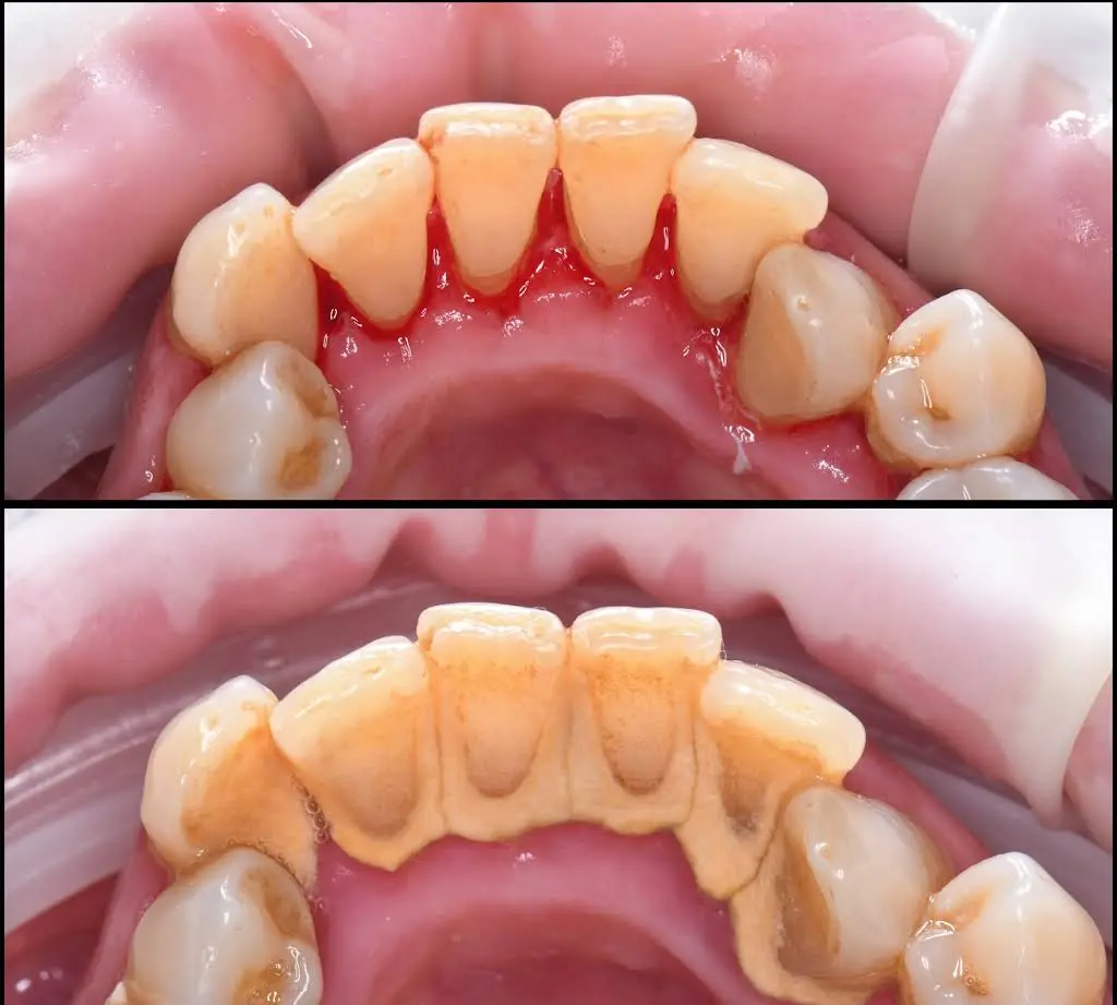 Eco Dental - He Harry Y DDS