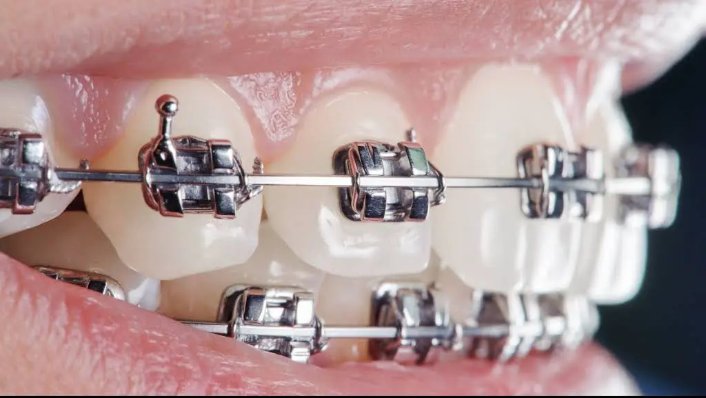 Eco Dental - He Harry Y DDS