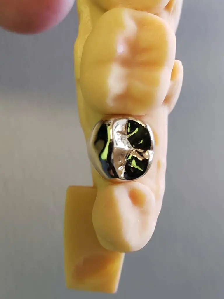 Eco Dental - He Harry Y DDS