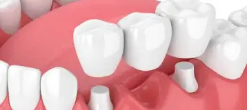 DeWire Dental