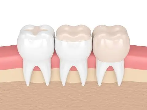 DeWire Dental