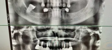 Myrtle Grove Implant and Family Dentistry