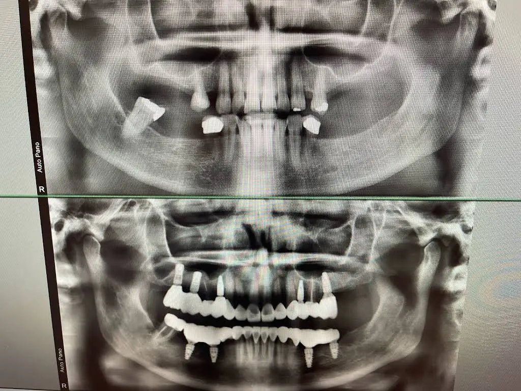 Myrtle Grove Implant and Family Dentistry