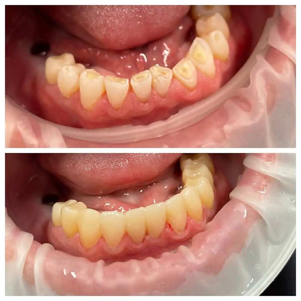 Myrtle Grove Implant and Family Dentistry
