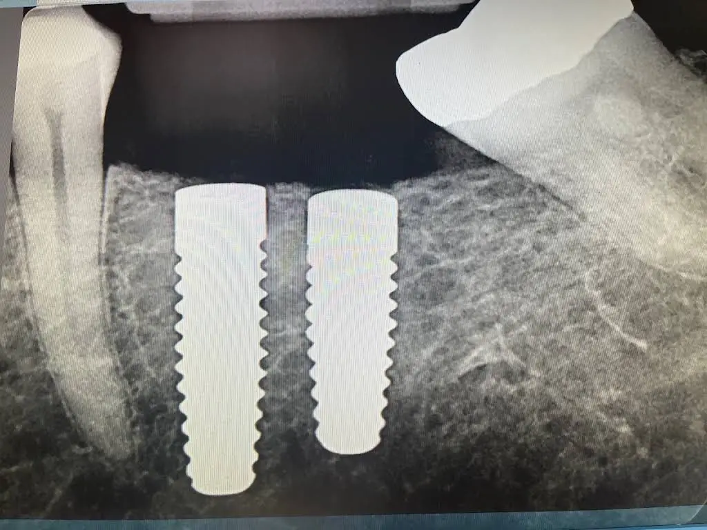 Myrtle Grove Implant and Family Dentistry