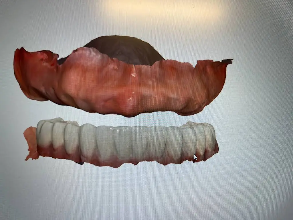 Myrtle Grove Implant and Family Dentistry