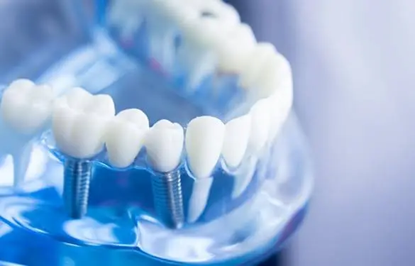 Curley Implant & General Dentistry