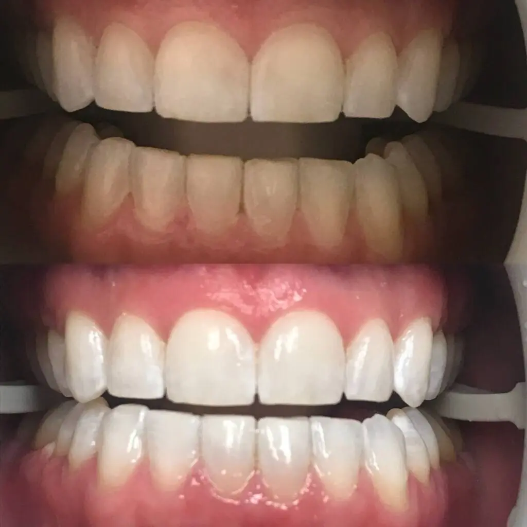 Beach Family Dentistry