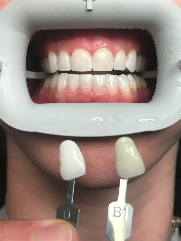 Beach Family Dentistry