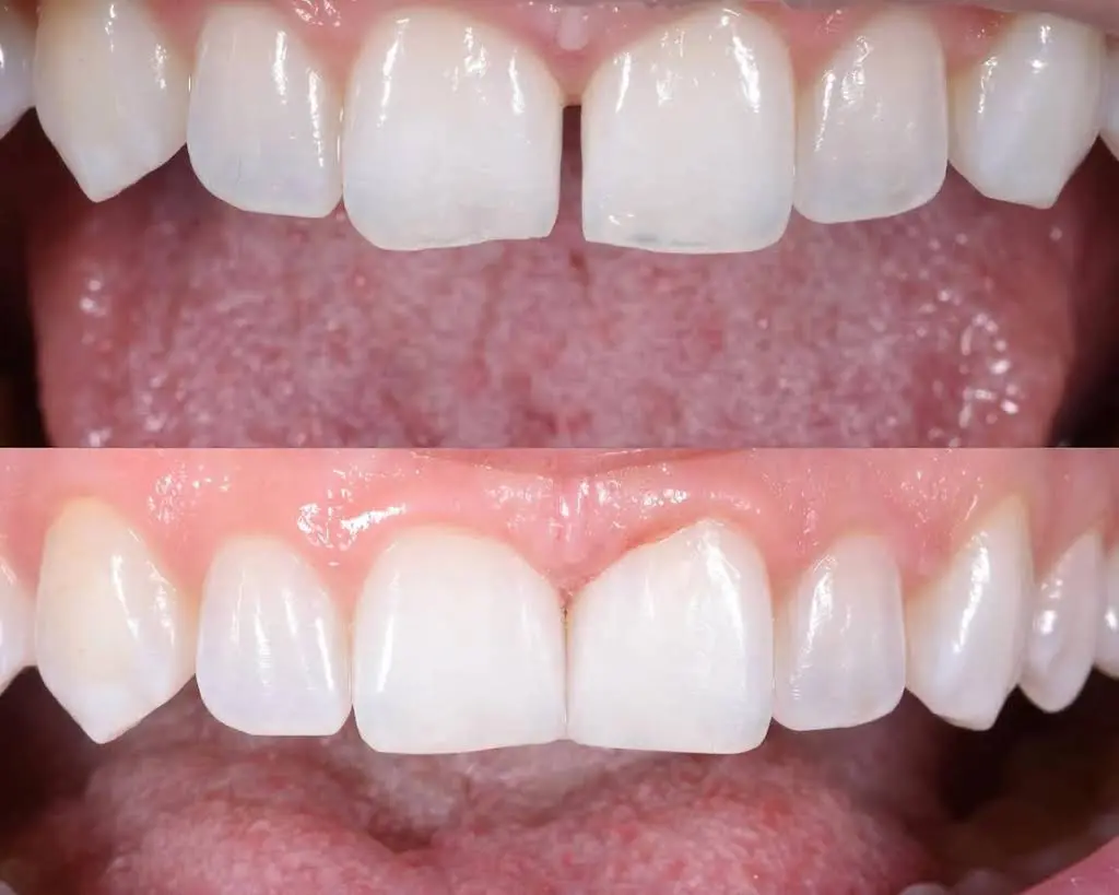 Ocean Bay Dental Care