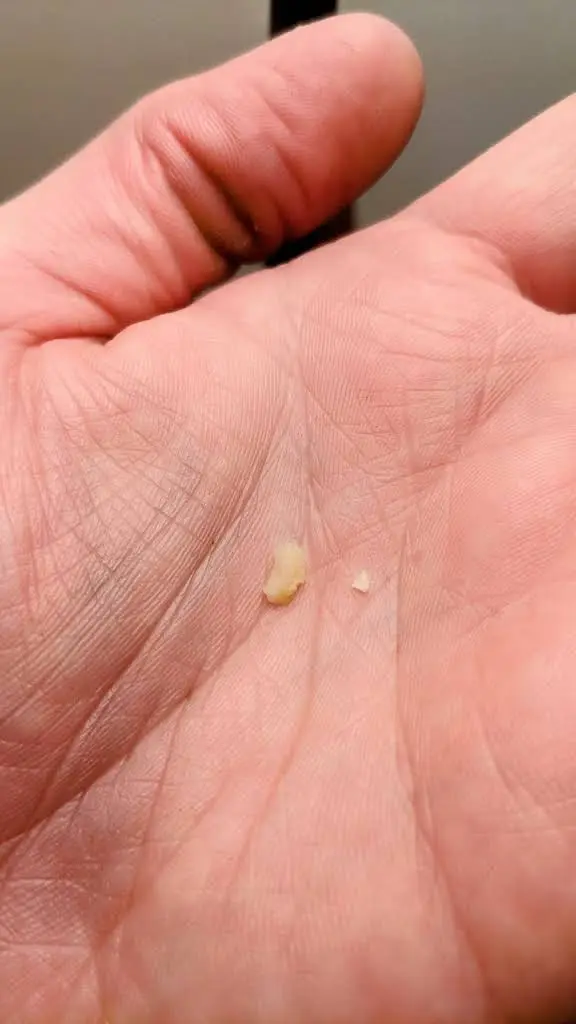 Carp Dental