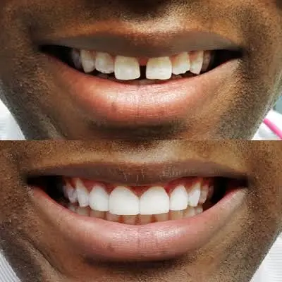 King of Prussia Dental Associates