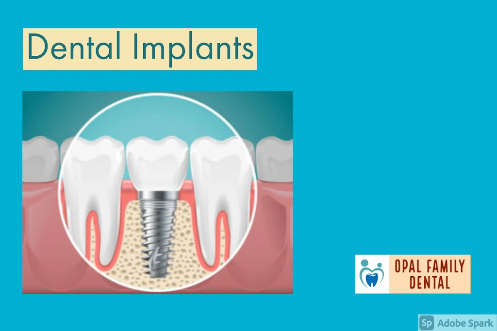 Opal Family Dental