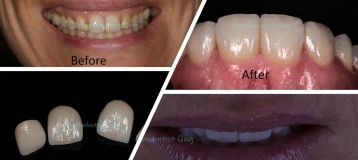 Bucks Dental Health and Esthetics