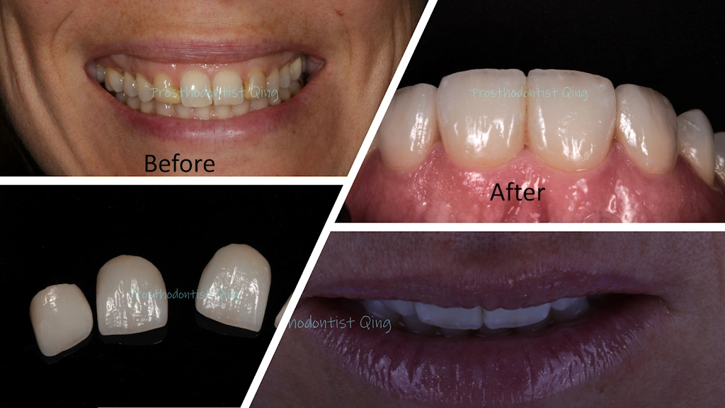 Bucks Dental Health and Esthetics - Professional dental clinic exterior with modern facilities