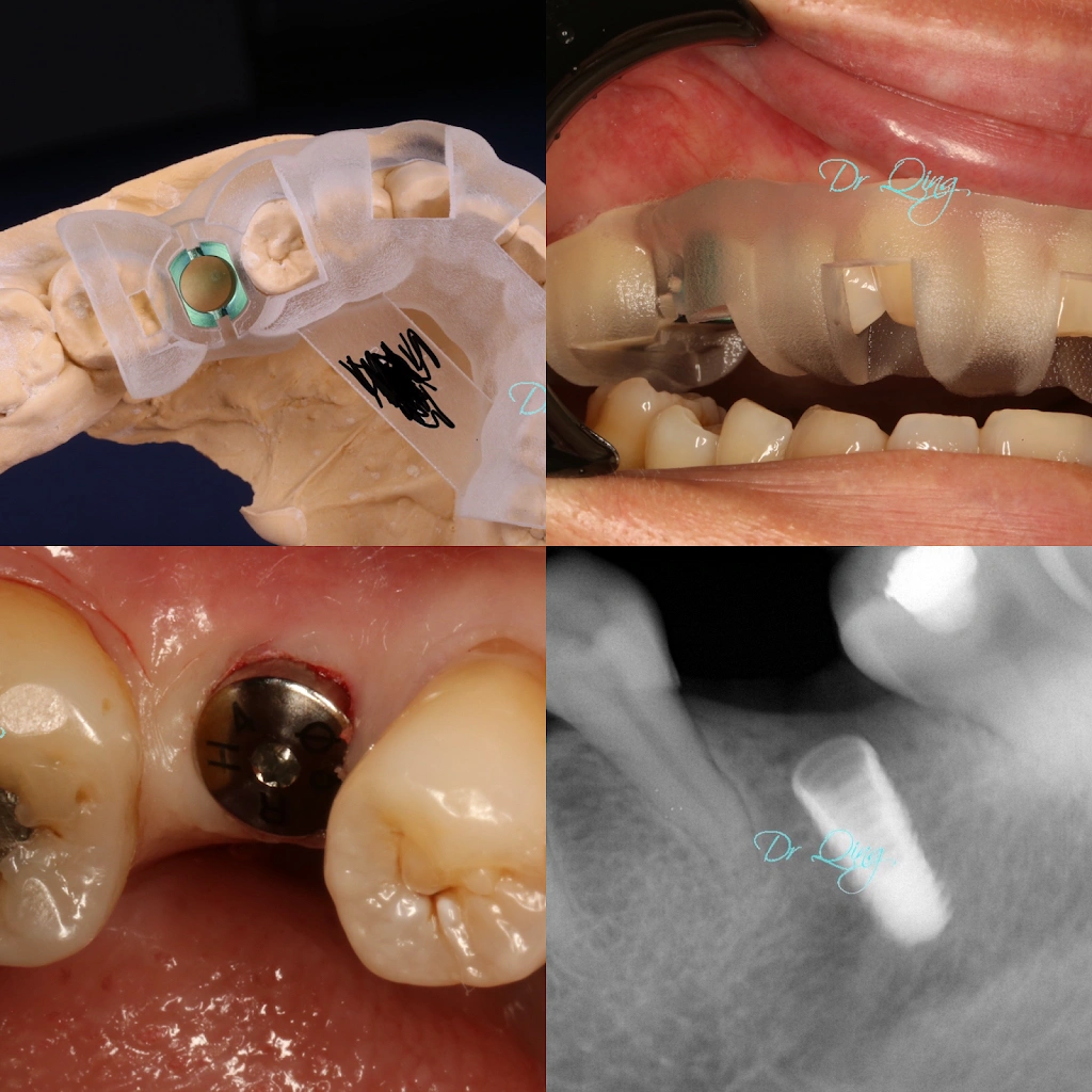 Bucks Dental Health and Esthetics