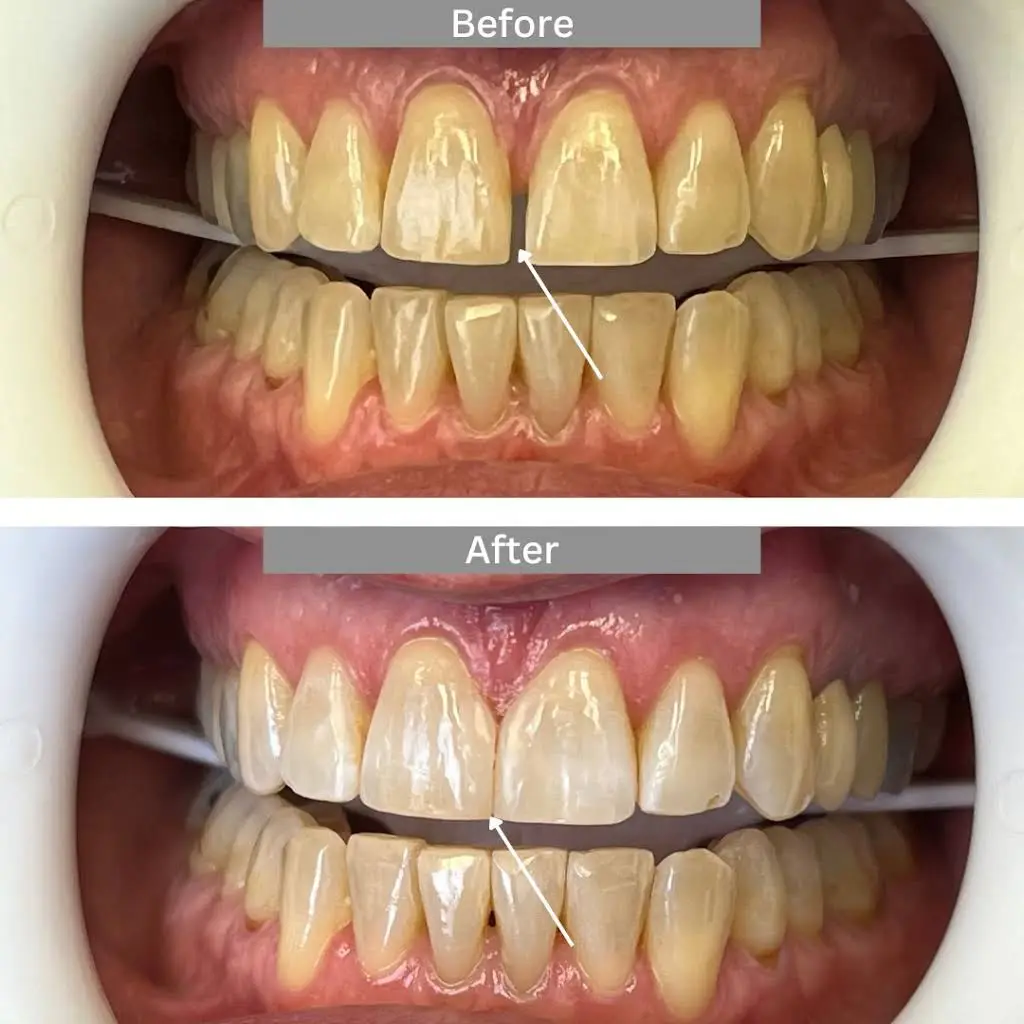 Pennbrook Dentistry North Wales