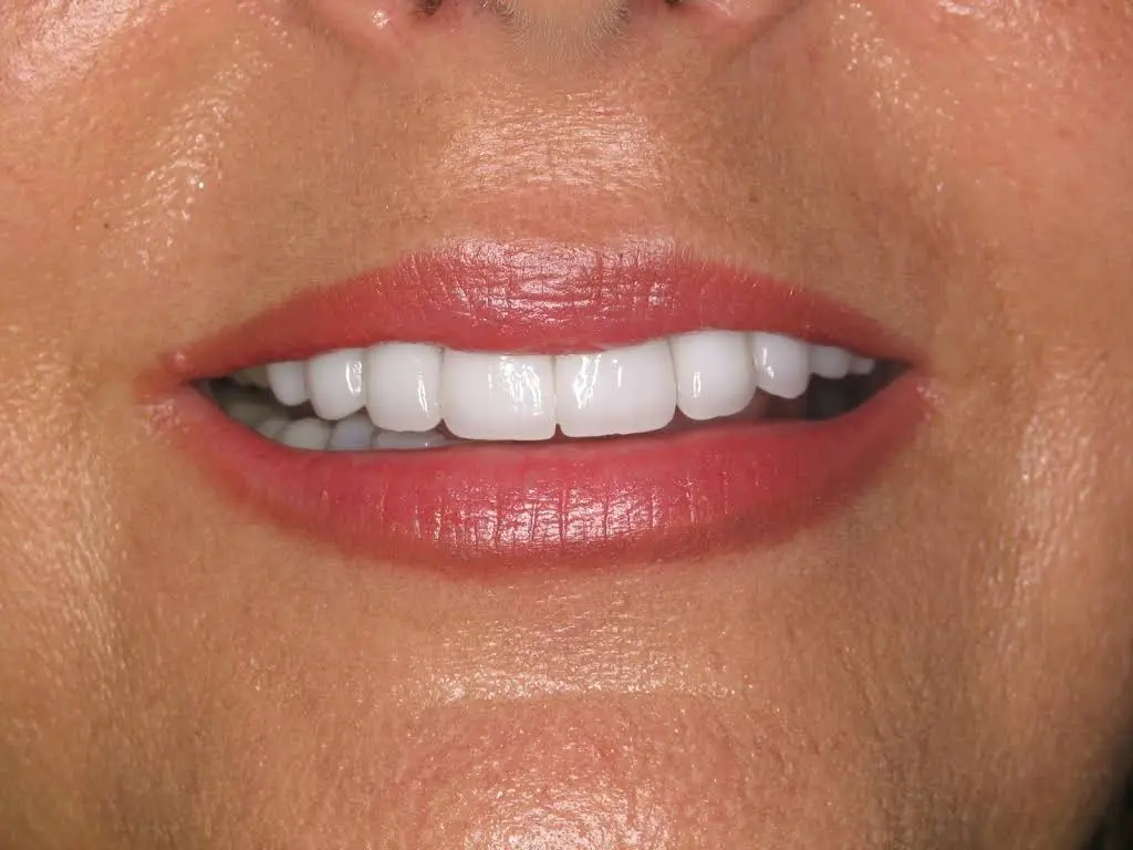 Leading Dental Solutions