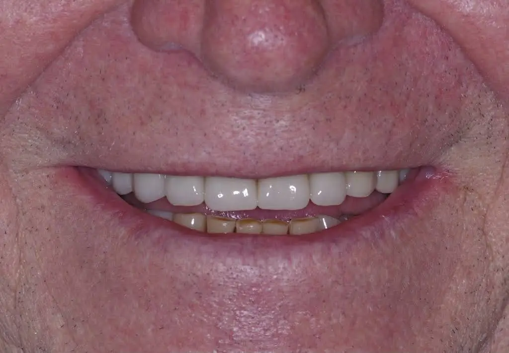 Buxmont Prosthodontics & Restorative Dentistry