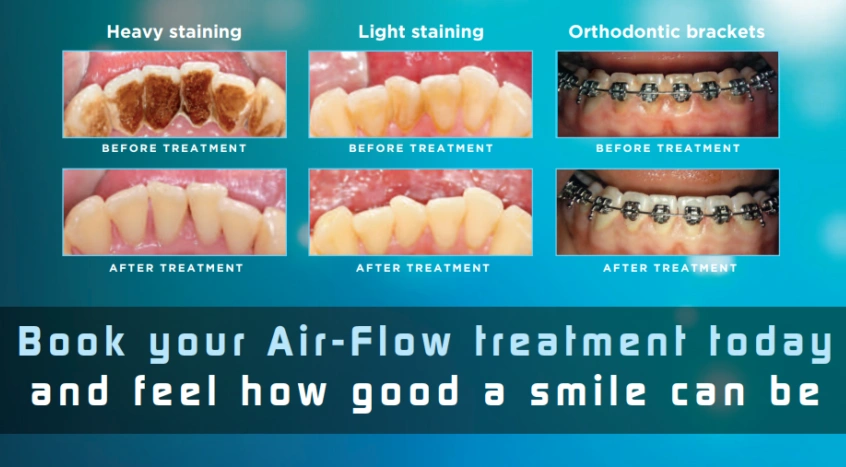 Advanced Dental Esthetics