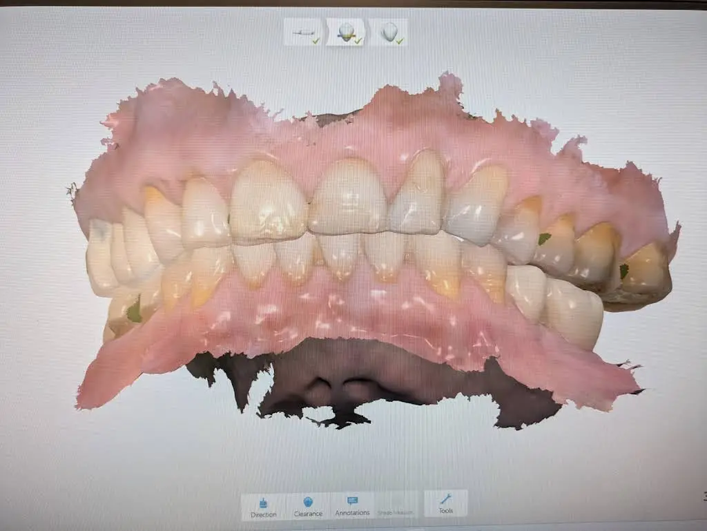 Aspen Dental