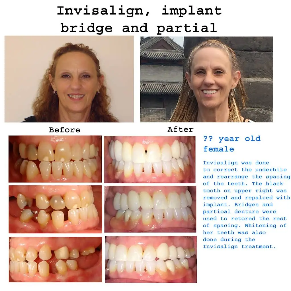Hunterdon Family Dental Care