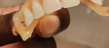 Affordable Dentures & Implants