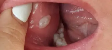 Inlet Premier Implant & Cosmetic Dentistry