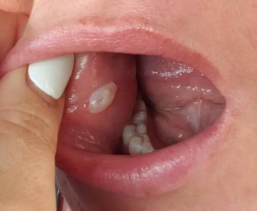 Inlet Premier Implant & Cosmetic Dentistry - Professional dental clinic exterior with modern facilities