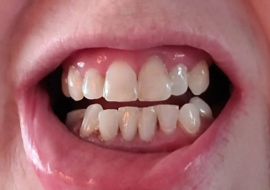 Inlet Premier Implant & Cosmetic Dentistry