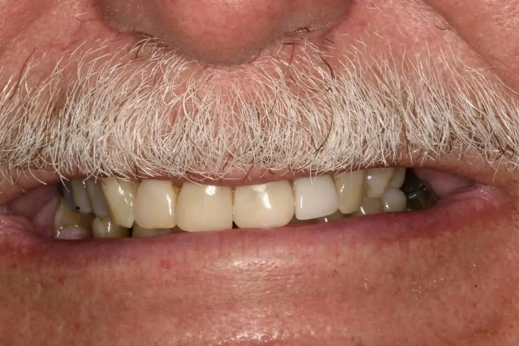 Family Dental Health of Litchfield