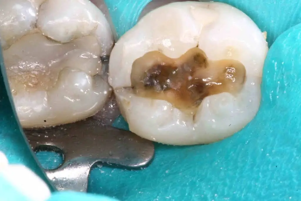 Family Dental Health of Litchfield