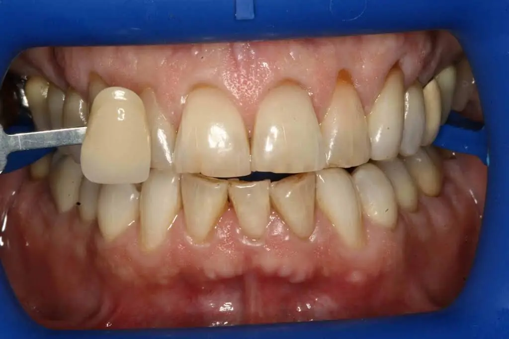 Waccamaw Dental Care