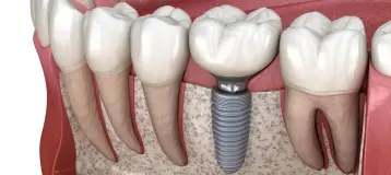 Crescent Family and Cosmetic Dentistry